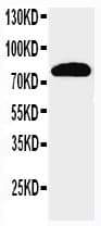 Polyclonal Rabbit anti-Human NCSTN / Nicastrin Antibody (aa72-88, WB)