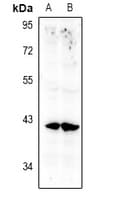 Polyclonal Rabbit anti-Human ANXA10 / Annexin A10 Antibody (WB)
