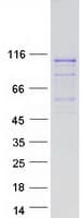 Human LRRC41 Protein (Recombinant Myc-DDK (Flag))