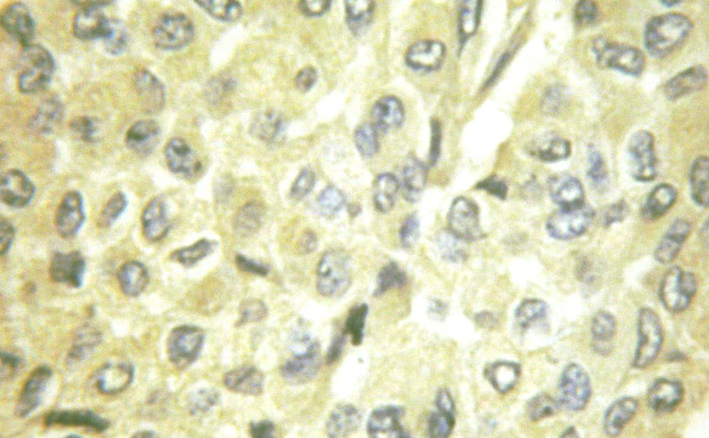 Polyclonal Rabbit anti-Human PIK3R1 / p85 Alpha Antibody (IHC, IF, WB)