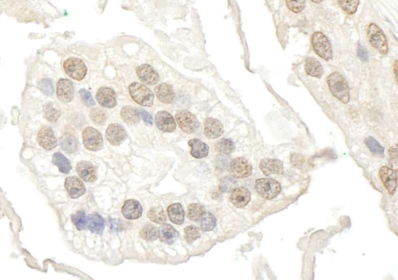 Polyclonal Rabbit anti-Human BRD7 Antibody (aa601-651, IHC)