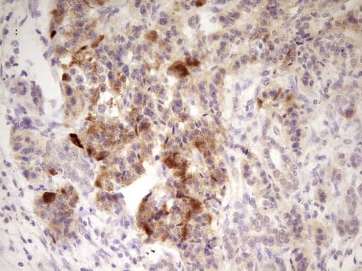 Monoclonal Mouse anti-Human ANGPTL3 Antibody (clone OTI5E6, Carrier-free, aa237-460, IHC, WB)