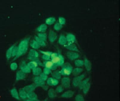 KDM5B / JARID1B Antibody (aa1534-1544)