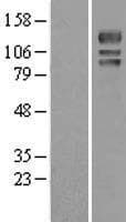 Human USP4 Protein (Over-Expression Lysate Myc-DDK (Flag))