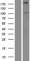SIPA1L2 Protein (Over-Expression Lysate Myc-DDK (Flag))