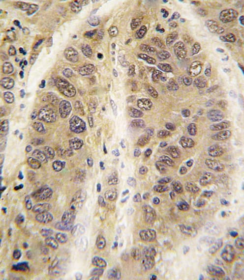 Polyclonal Rabbit anti-Human ADK / Adenosine Kinase Antibody (aa322-352, IHC, WB)