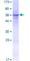 Human GATSL3 Protein (Recombinant GST)