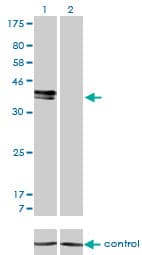 ISLET-1 / ISL1 Antibody (clone 1A3)