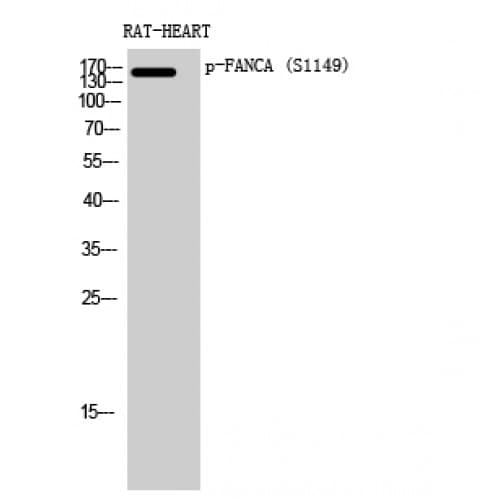 FANCA Antibody (1090-1170 aa)