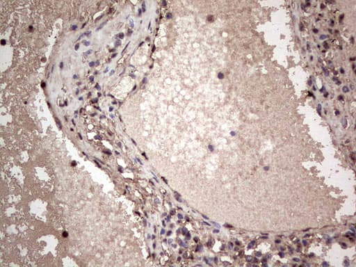 Monoclonal Mouse anti-Human SAE1 Antibody (clone OTI6B11, Carrier-free, IHC, WB)