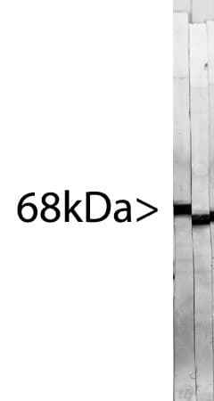 NF-L / NEFL Antibody (clone 7D1)