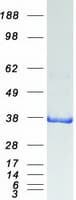 Human QKI Protein (Recombinant Myc-DDK (Flag))
