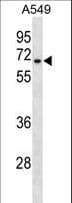 IHC-plus™ HAS3 Antibody (aa137-164)