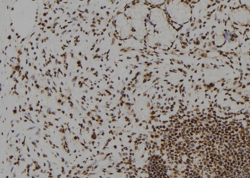 Polyclonal Rabbit anti-Human DYRK2 Antibody (IHC, WB)