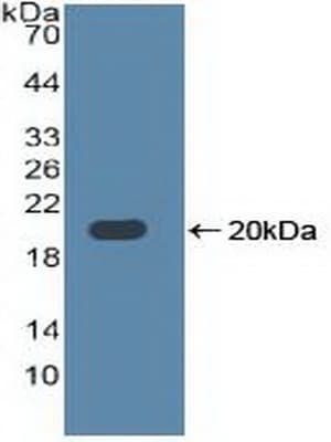 TLR3 Antibody (aa404-532, PE)