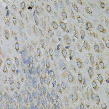 RPLP0 Antibody