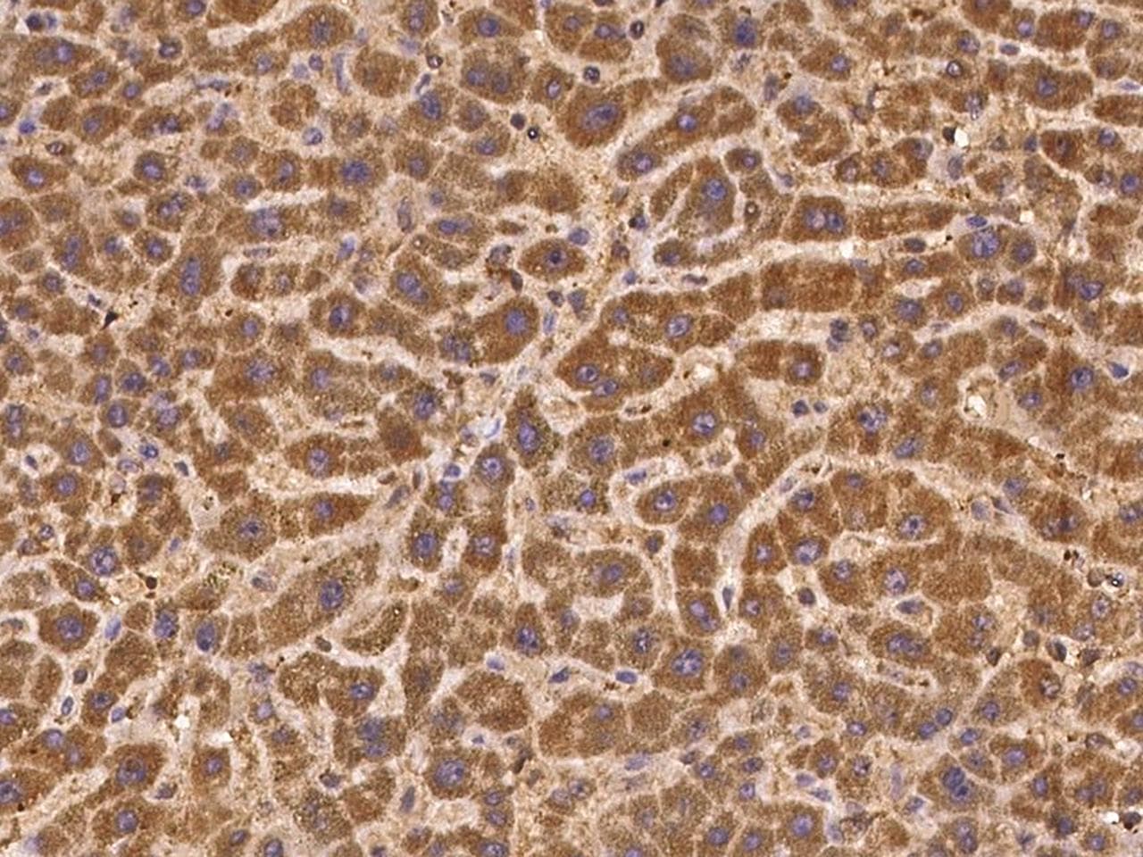 TRMT61B Antibody