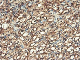 PFKP Antibody (clone OTI1F2)