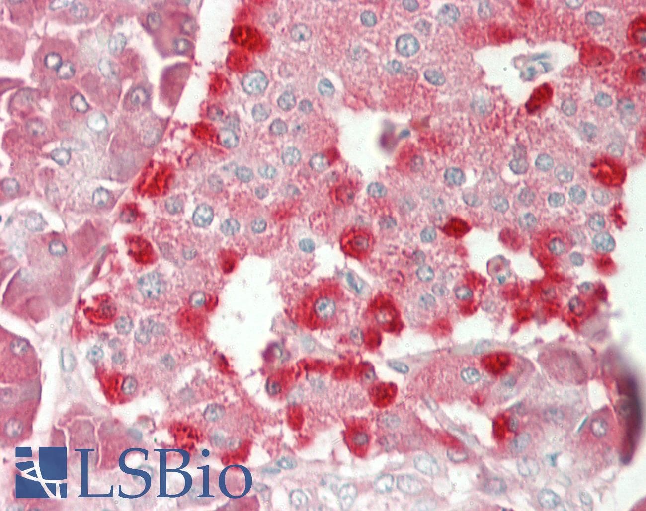 RPL10A Antibody (N-Terminus)