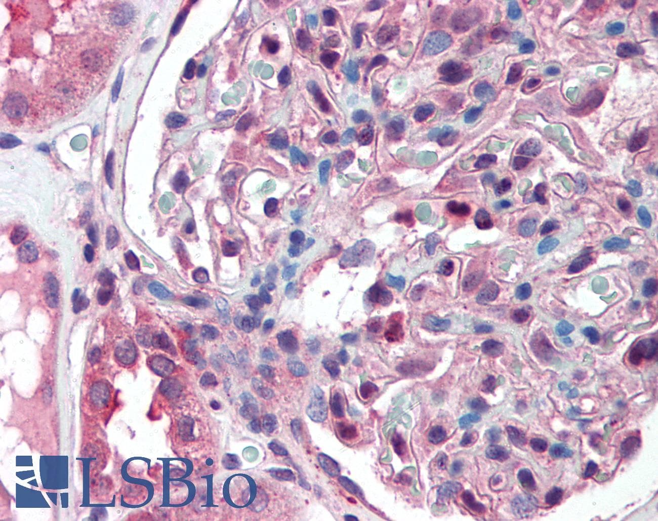 IHC-plus™ SLC39A14 / ZIP14 Antibody (Cytoplasmic Domain)
