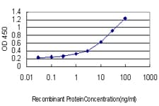 IHC-plus™ HTT / Huntingtin Antibody (clone 3F1)