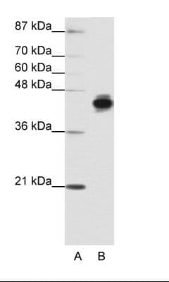 KRT18 / CK18 / Cytokeratin 18 Antibody (N-Terminus)