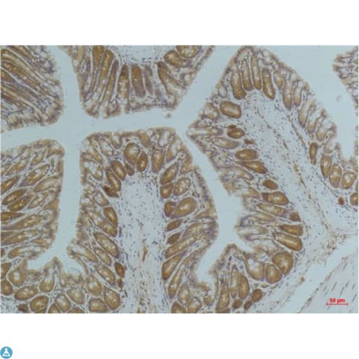 Monoclonal Mouse anti-Human PRKAA1 / AMPK Alpha 1 Antibody (IHC, WB)