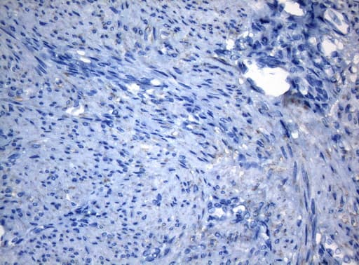 ZNF217 Antibody (aa730-1048, clone OTI1B10)