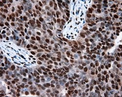 TLDC1 / KIAA1609 Antibody (clone OTI12B1)