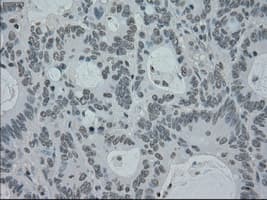 Monoclonal Mouse anti-Human PMEL / SILV / gp100 Antibody (clone OTI10E5, IHC, IF, WB)