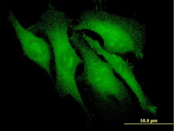 IHC-plus™ ARRB2 / Beta Arrestin 2 Antibody (clone 3G1)