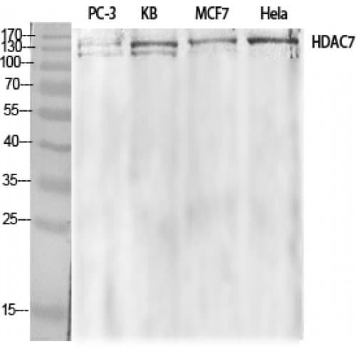 HDAC7 Antibody (90-170 aa)