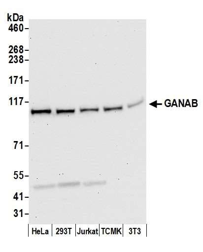 GANAB / Alpha Glucosidase II Antibody (aa894-944)
