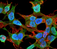 Monoclonal Mouse anti-Rat NLGN1 / Neuroligin 1 Antibody (clone S97A-31, aa718-843, IF, WB)