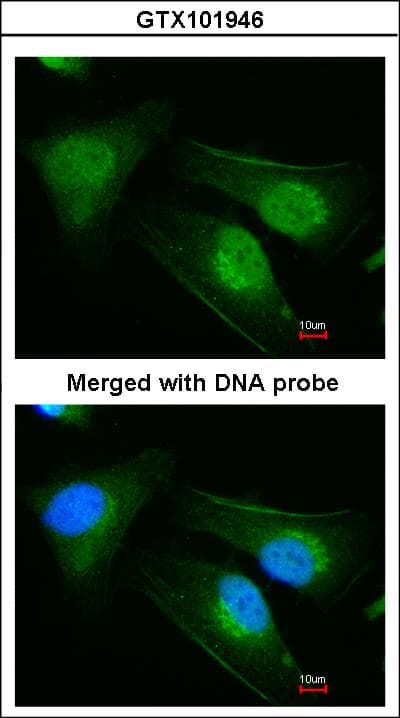 IHC-plus™ DNAJB6 Antibody (aa1-116)