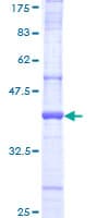 Human HACE1 Protein (Recombinant GST, N-terminus)