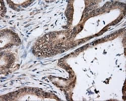 NIT2 Antibody (clone OTI6H7)