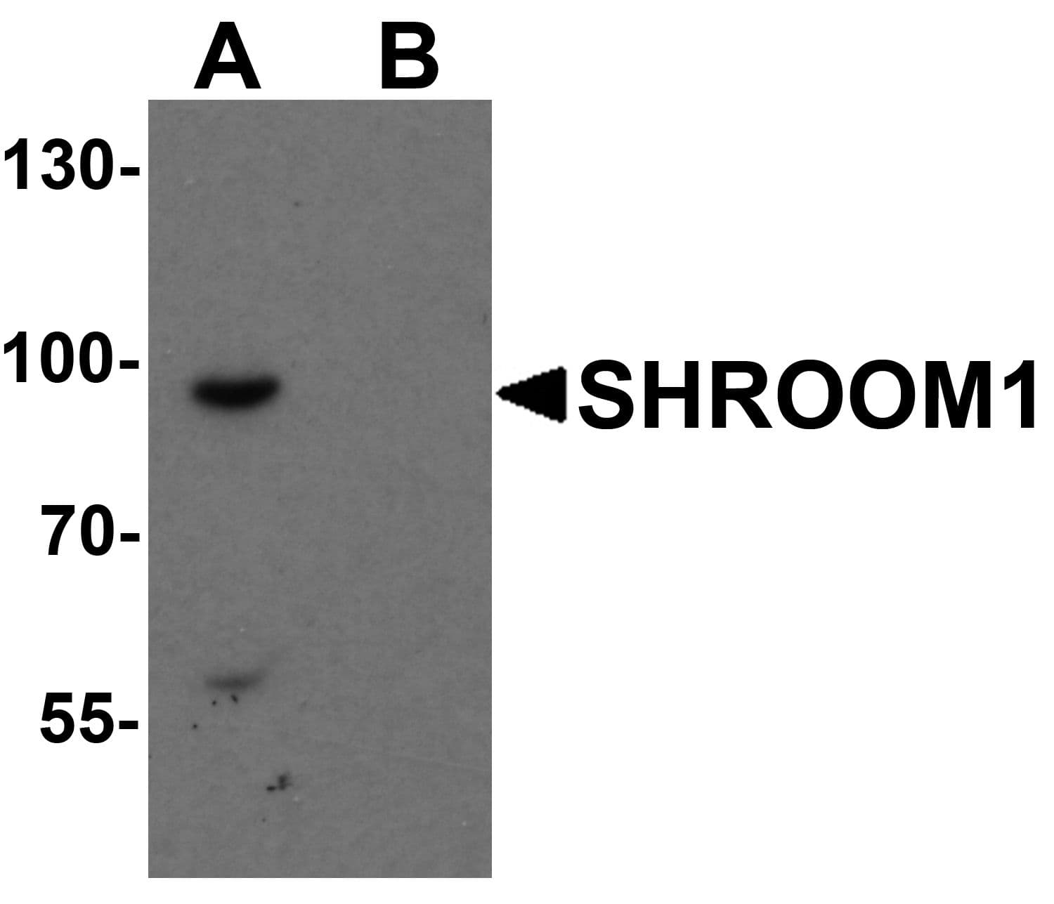 Polyclonal Rabbit anti-Human SHROOM1 Antibody (WB)