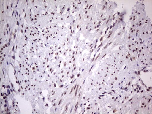 LPIN1 / Lipin 1 Antibody (clone OTI1B7, Carrier-free)