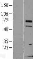 TCTN3 Protein (Over-Expression Lysate Myc-DDK (Flag))