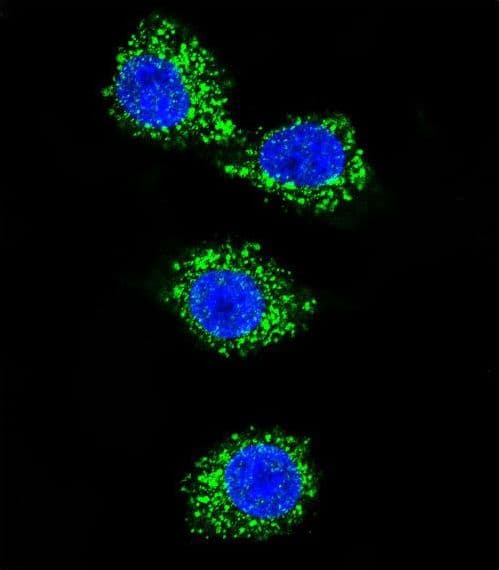 MPP3 Antibody (aa406-434)