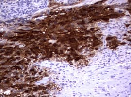 Monoclonal Mouse anti-Human TS / Thymidylate Synthase Antibody (clone OTI1D6, IHC, WB)