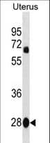 VGLL4 Antibody (aa136-163)