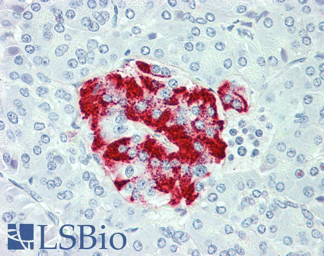 IHC-plus™ SLC7A2 Antibody (C-Terminus)