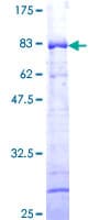 Human TTC4 Protein (Recombinant GST)