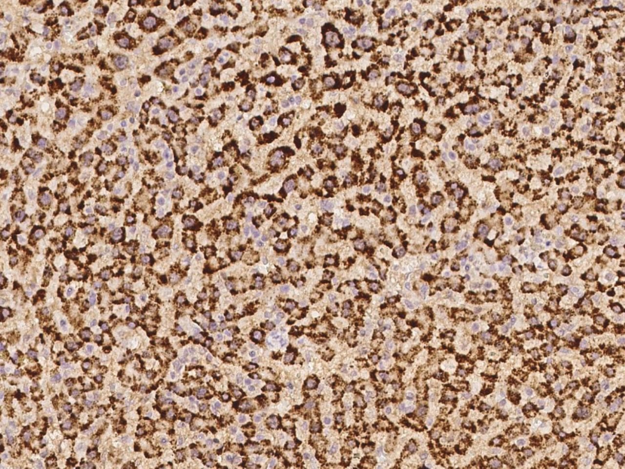 FABP12 Antibody