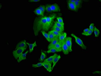 Polyclonal Rabbit anti-Human CLDN6 / Claudin 6 Antibody (IHC)