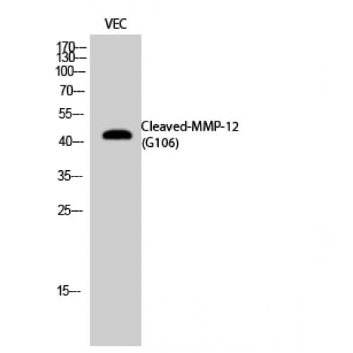MMP12 Antibody (60-140 aa, Internal)
