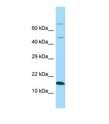 GABARAPL1 / ATG8 Antibody (aa31-80)