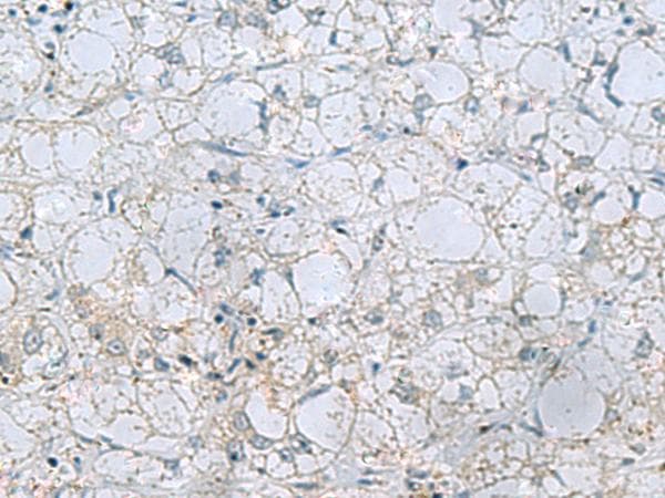 NAGK Antibody